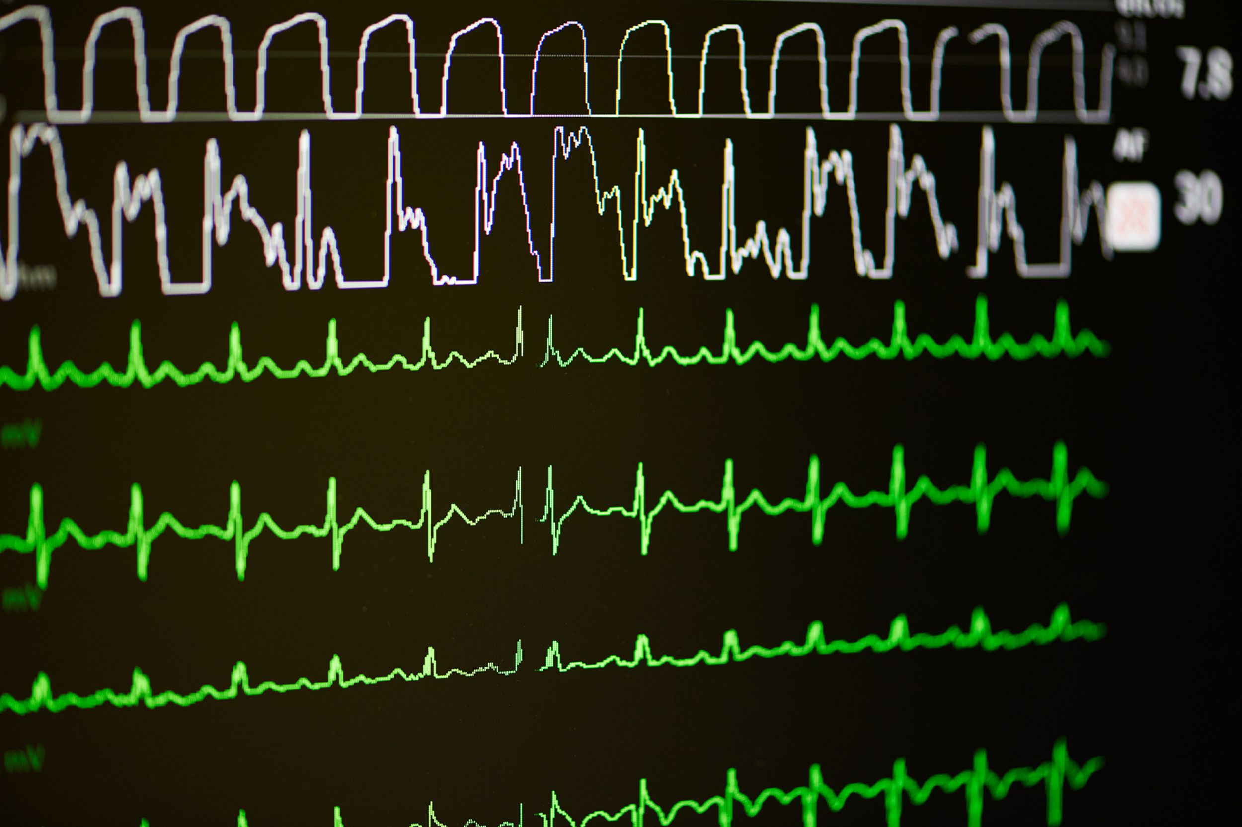 Ein Bildschirm mti Vitalwerten