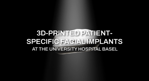 Neues Kinn durch 3D-Druck am Universitätsspital Basel