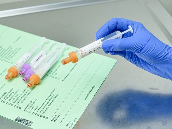 Neuer Blutmarker hilft bei Behandlung und Erforschung der Multiplen Sklerose